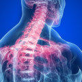 Can chiropractor cause nerve damage?